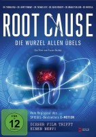 Root Cause - Die Wurzel allen Übels (DVD) 